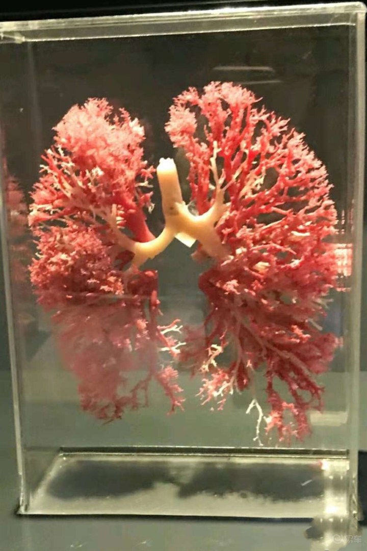 ˵ķεͼ